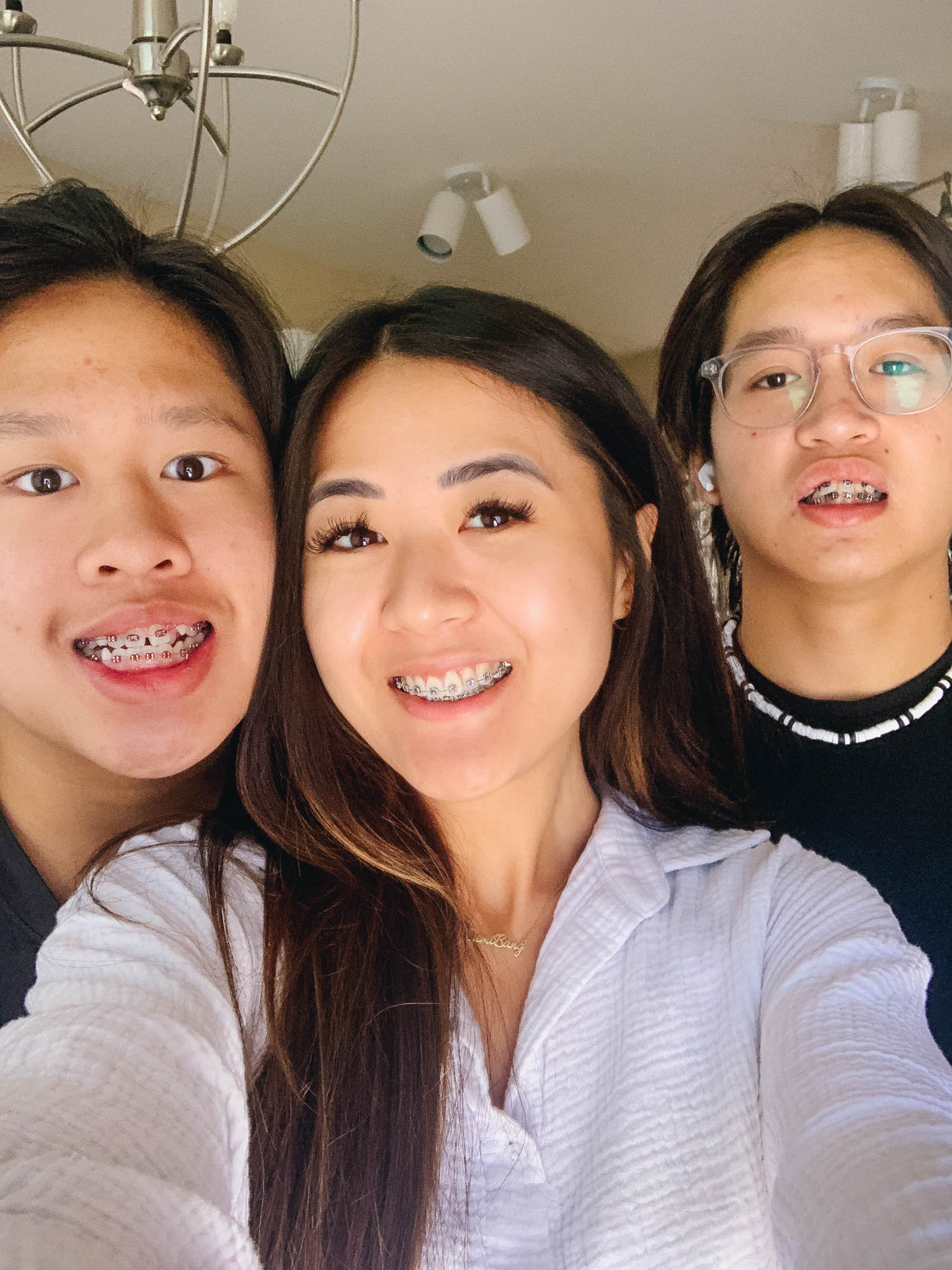 Blogger Demi Bang talks about getting braces as an adult.